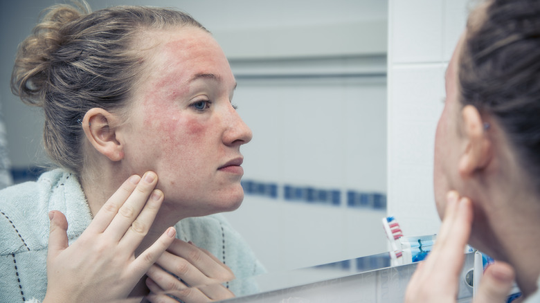 Woman looking in mirror at skin breaking out