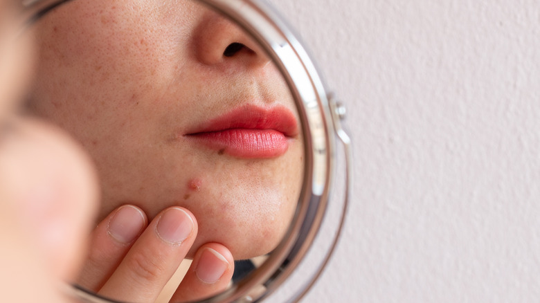 Person with acne's reflection in mirror