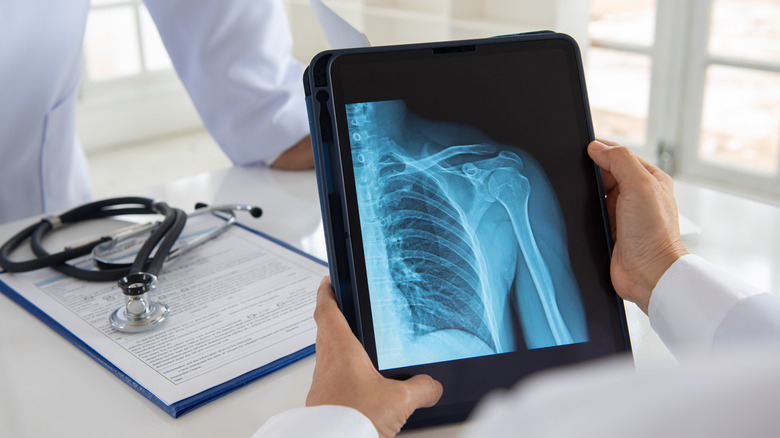 Shoulder joint x-ray image on digital tablet