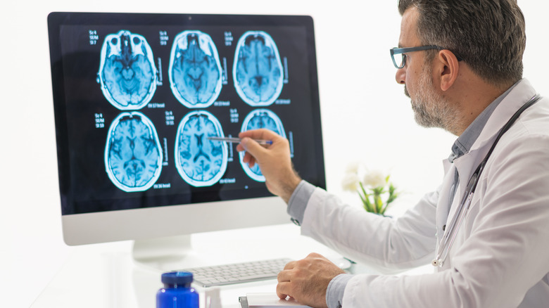 Doctor examining a brain MRI