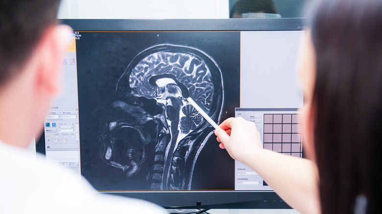 Doctors examining MRI image of brain