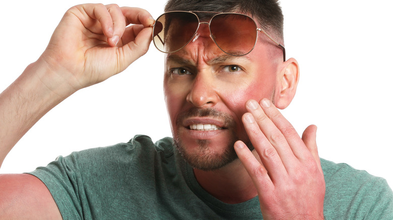 Man raising sunglasses pointing to sunburn