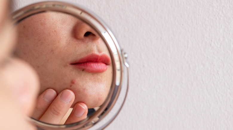 Woman looking a pimple in a mirror