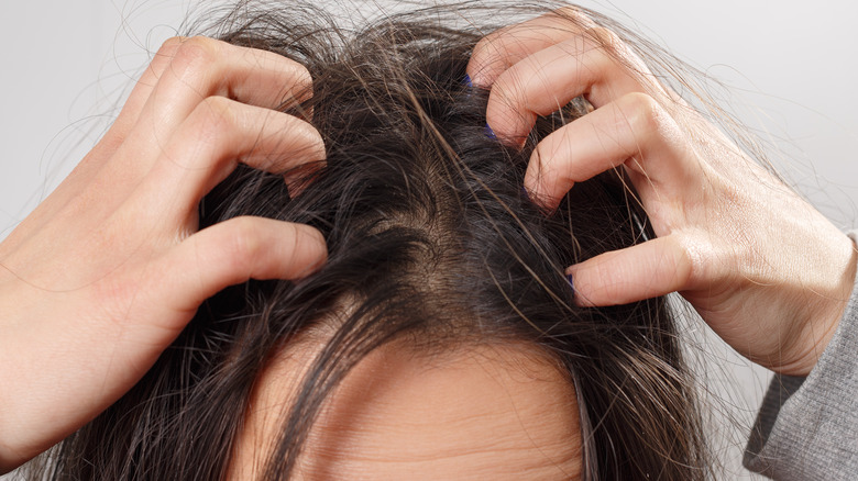 Woman scratching her scalp