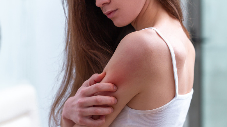 woman with itchy skin