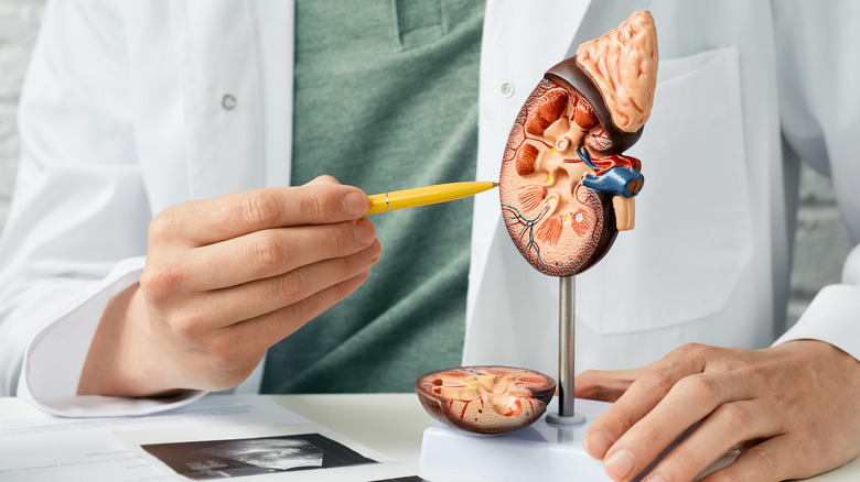 A doctor points to a model of a kidney