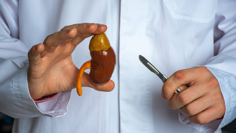 doctor holding model kidney