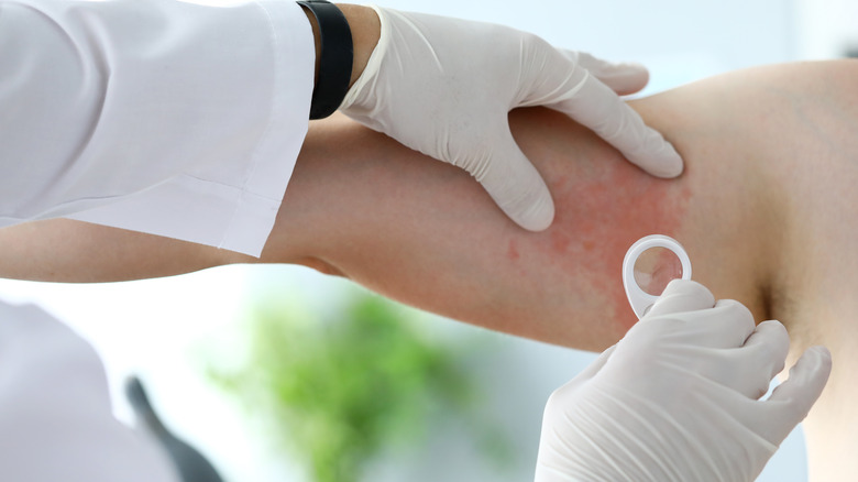 doctor examining patient's skin