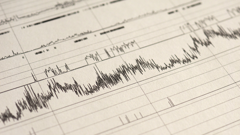 polysomnogram sleep study results