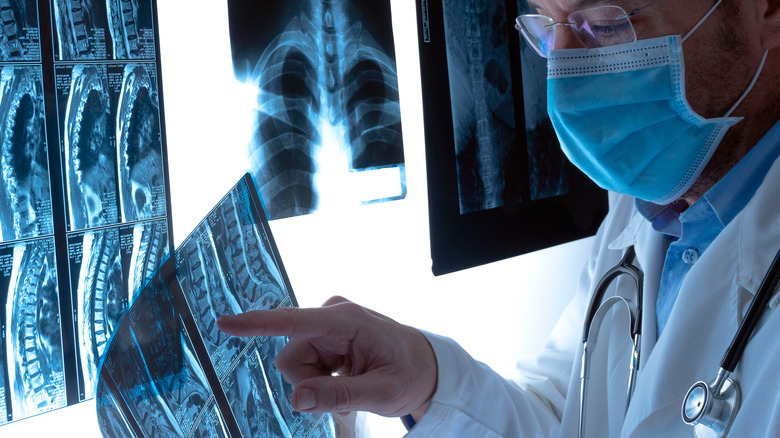 A doctor examining x-ray results