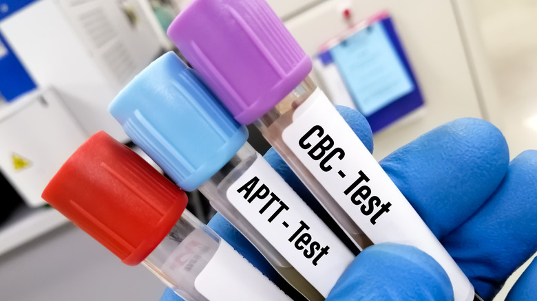 complete blood count and APTT test for clotting time