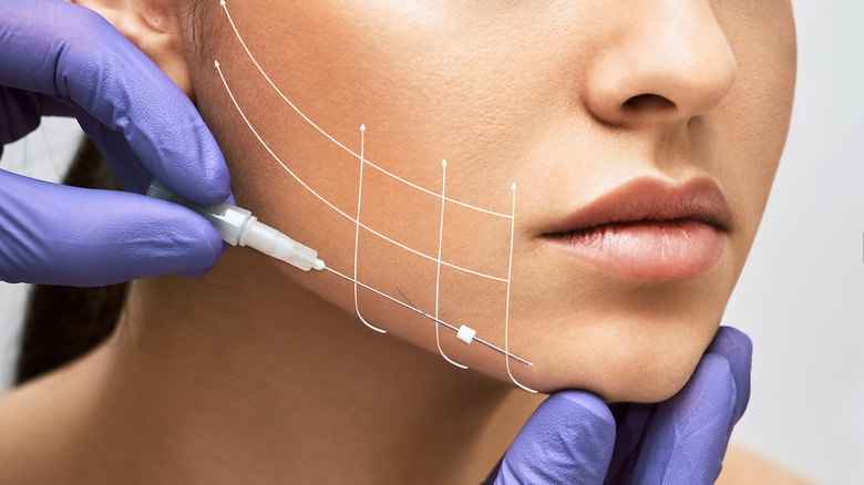 surgeon contouring woman's face