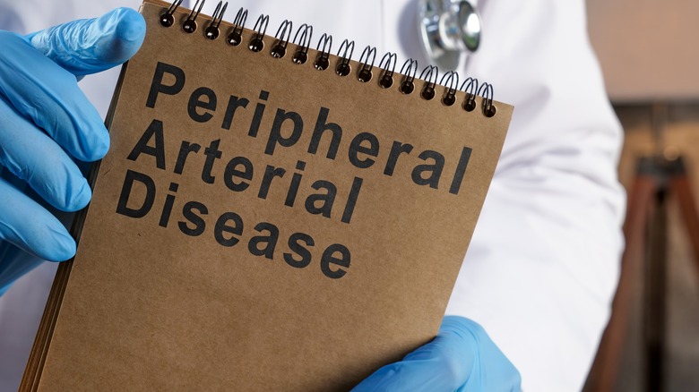 notepad saying 'peripheral arterial disease'
