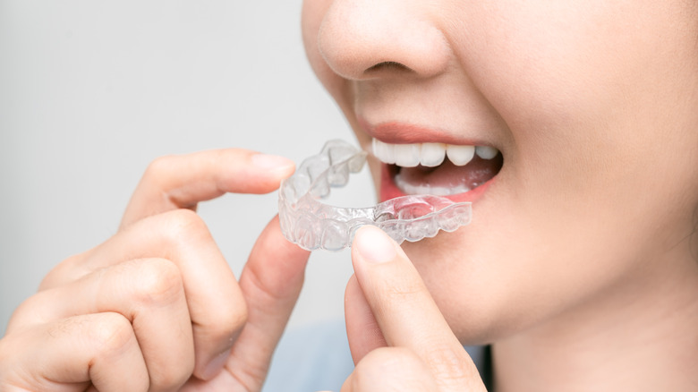 Person inserting mouth guard