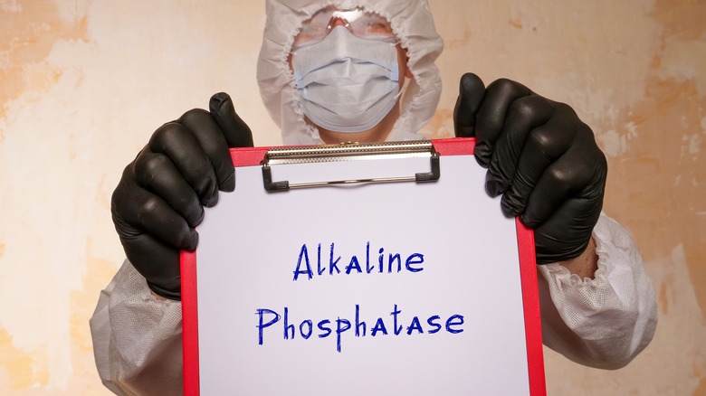 doctor holding alkaline phosphatase signage