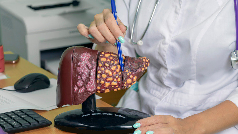 doctor pointing at liver model