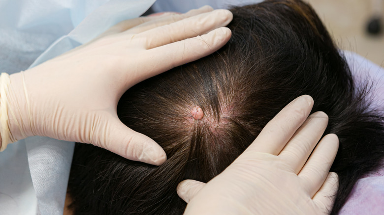 Examination of scalp