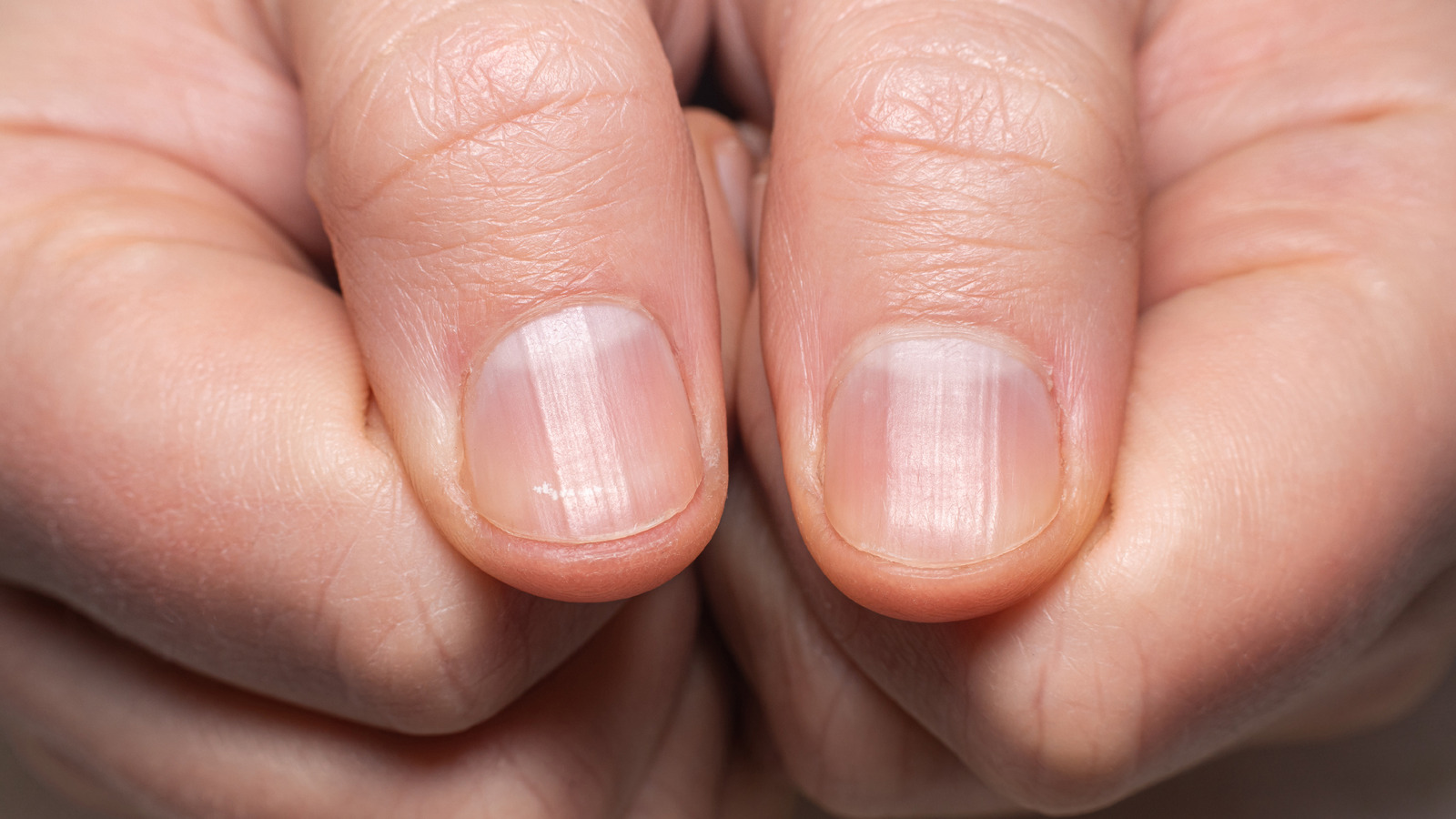 Why can't I grow my fingernails? They split or just crack to where I have  to file them down to nothing. What am I doing wrong? - Quora