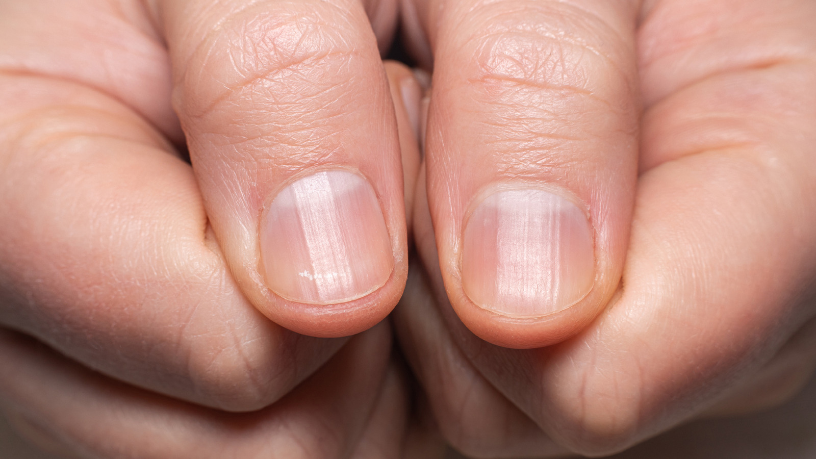 What It Really Means When Your Fingernails Won t Grow