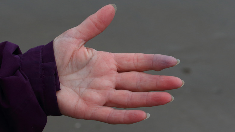 Hand with purple fingertip