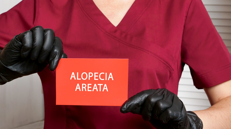 woman in scrubs holding the sign 'alopecia areata'