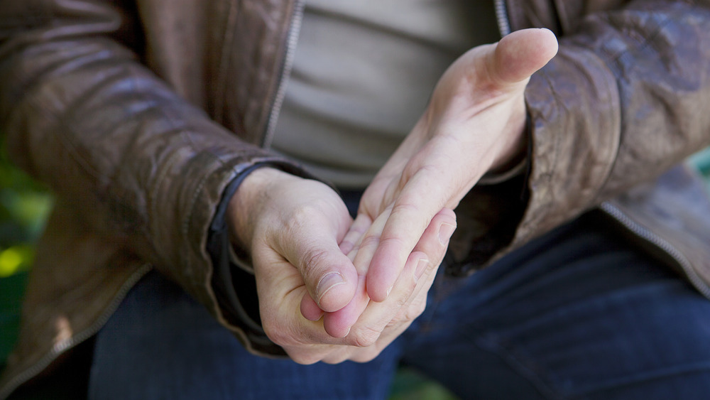 hands showing a Raynaud's flare