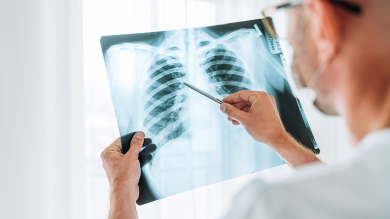 Doctor examining a patient chest X-ray