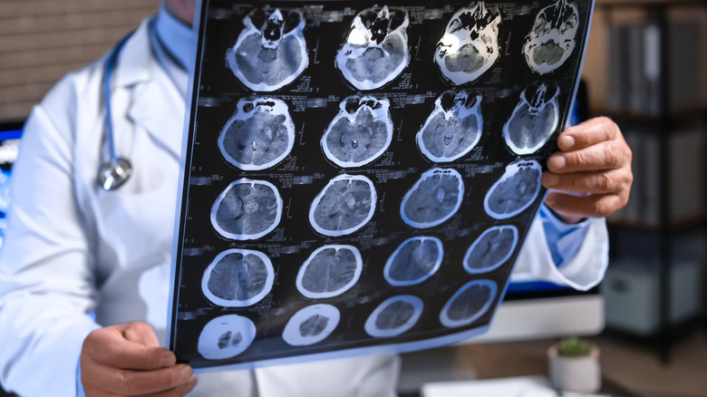 Doctor holding brain scans