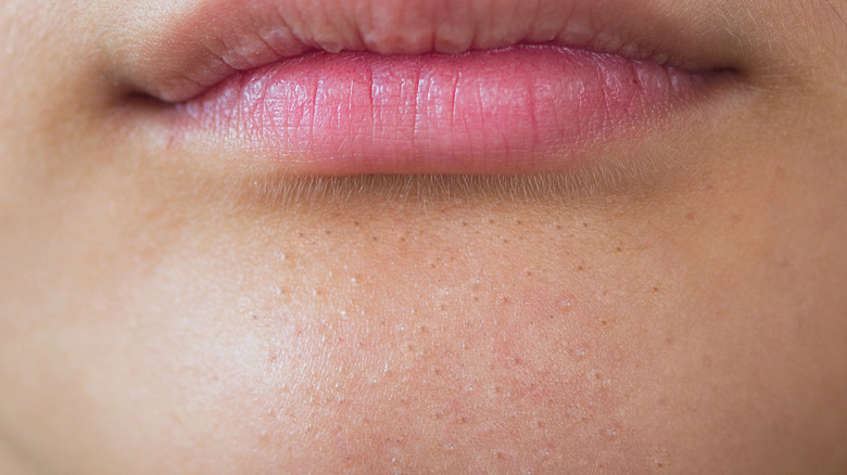 The Best and Worst Ways to Get Rid of Blackheads