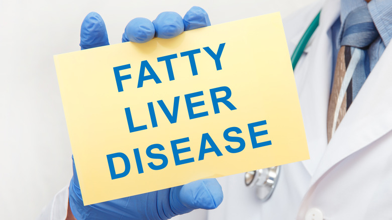 doctor holding FATTY LIVER DISEASE sign
