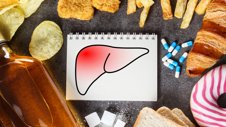 liver drawing surrounded by junk food