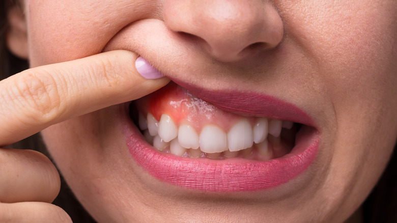 Woman examining her gum color