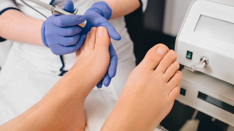 Close up of doctor examining yellow toenails with fungal infection
