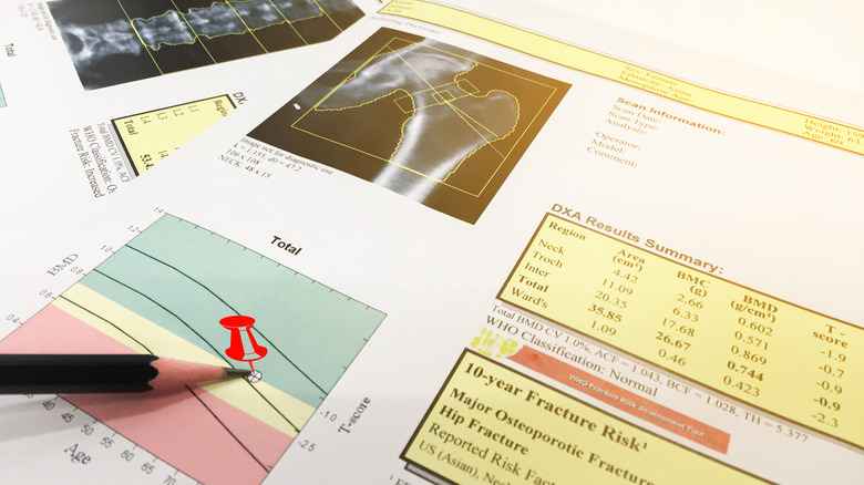 Closeup of DEXA scan results