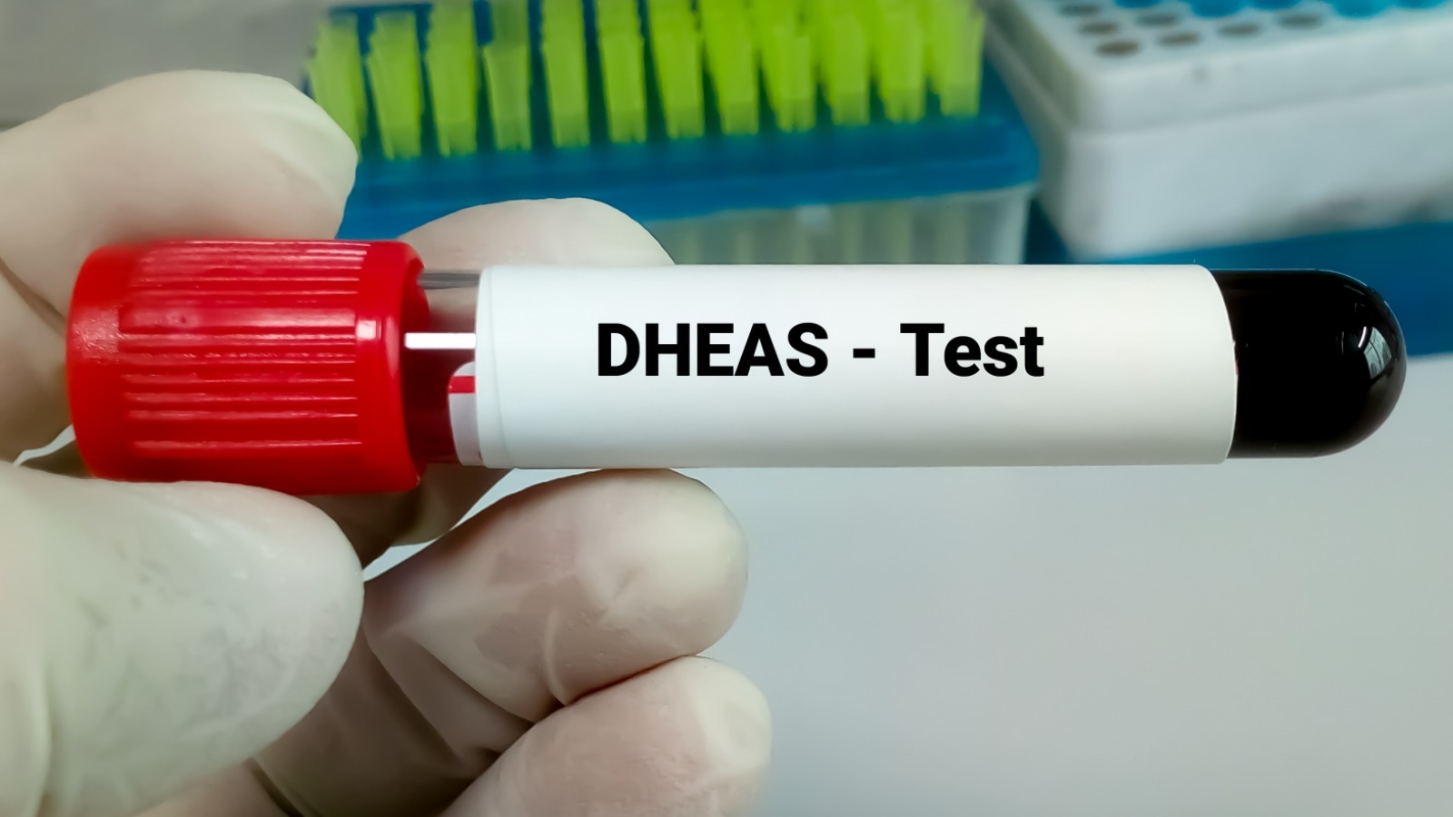 what-to-expect-when-getting-a-dhea-test