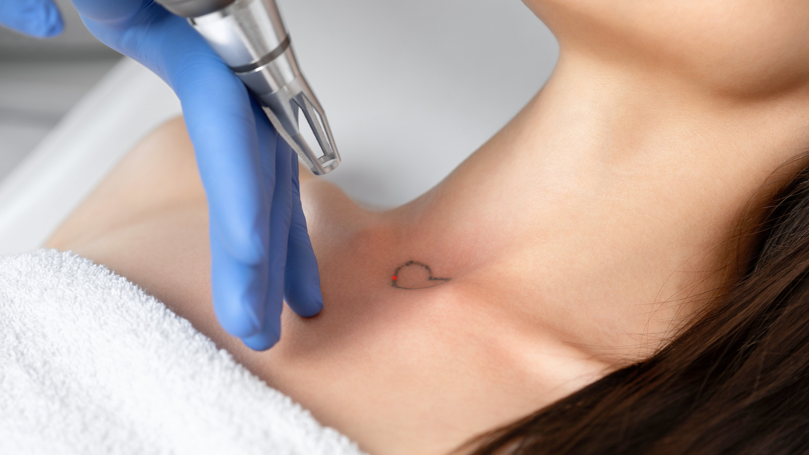 How Fine Line Tattoo Removal Works  Certified Tattoo Studios