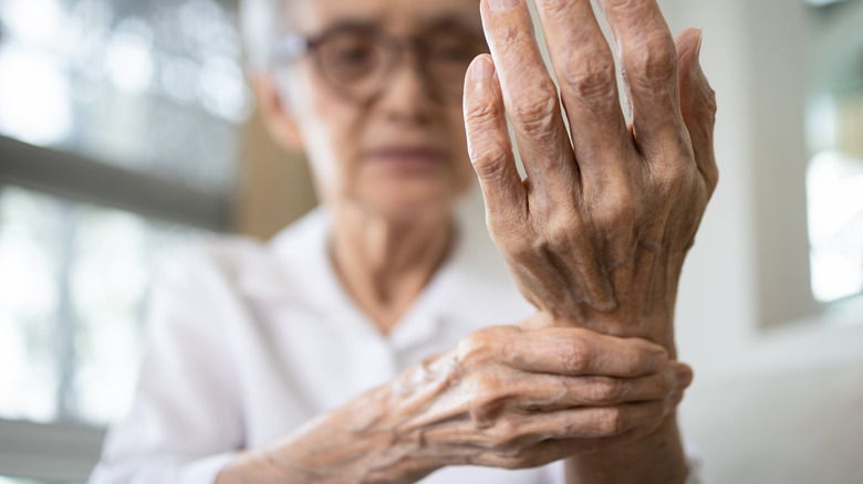 A woman has arthritis in her hands