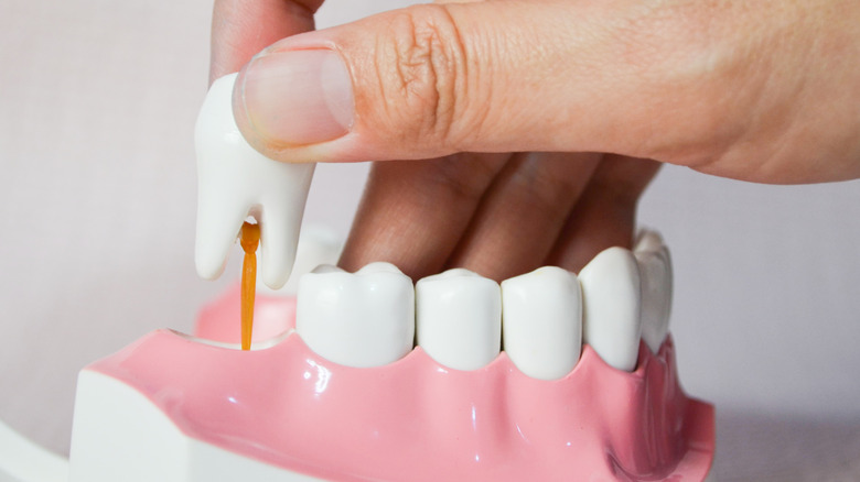 Tooth being removed from model of gums