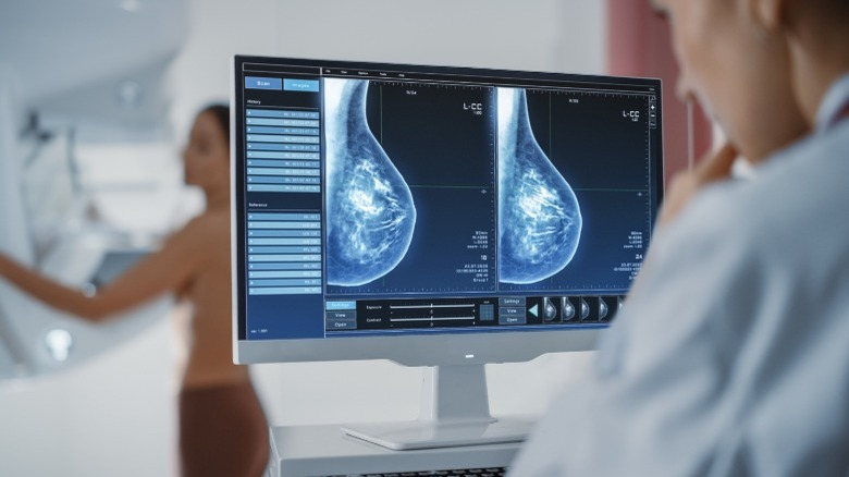 woman getting mammogram