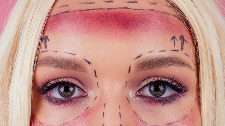 Blonde woman with red marks on her face from too many plastic surgery procedures