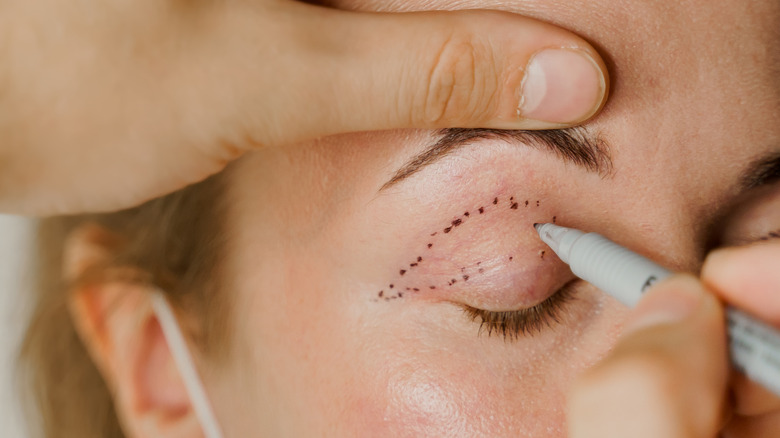 a doctor works on a plastic surgery patient