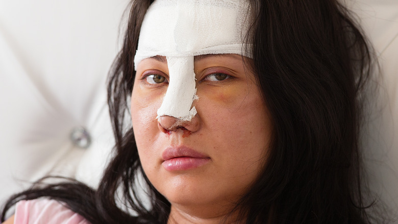 Recovering plastic surgery patient