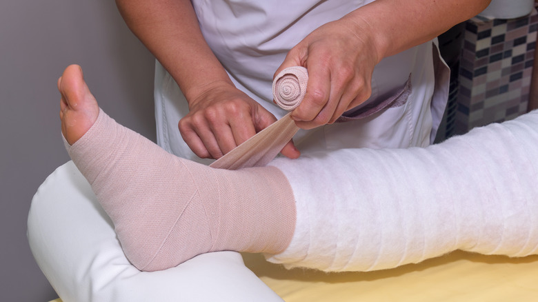 nurse putting lymphedema bandages