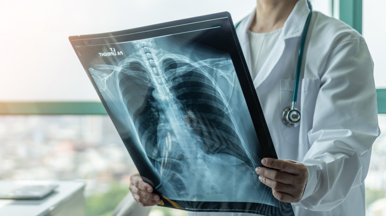 female nurse holding x-ray images