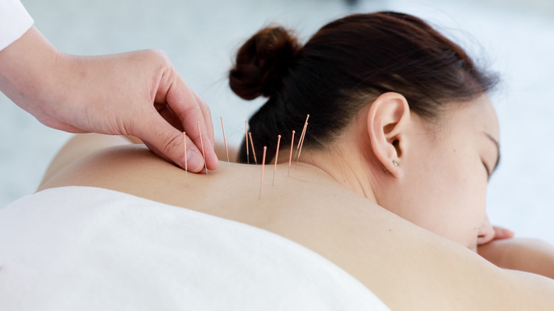 spinal acupuncture