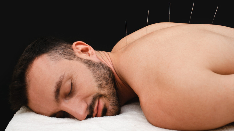 man relaxing during acupuncture
