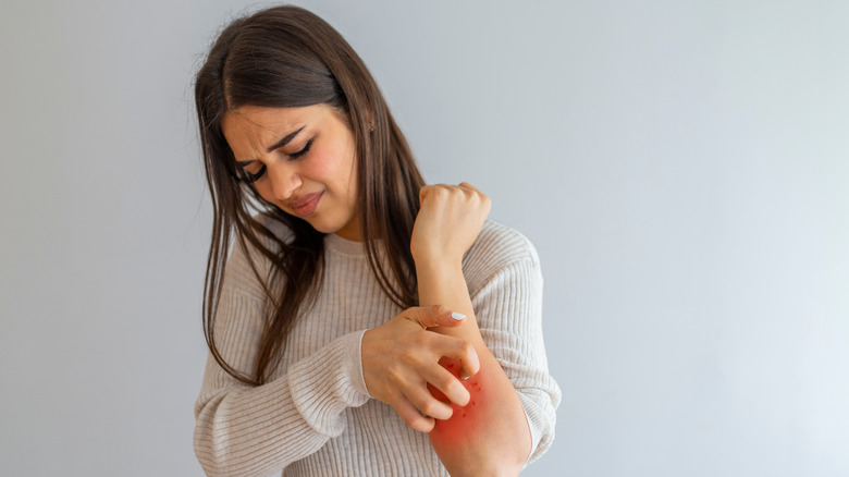 woman with itchy skin condition