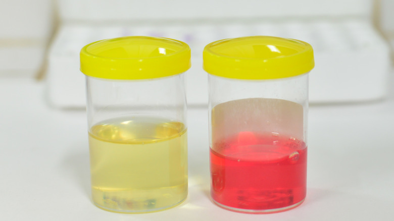 yellow and red urine samples