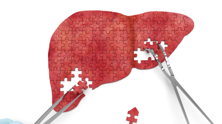 Liver puzzle with surgical tools