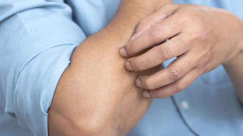 man scratching his forearm